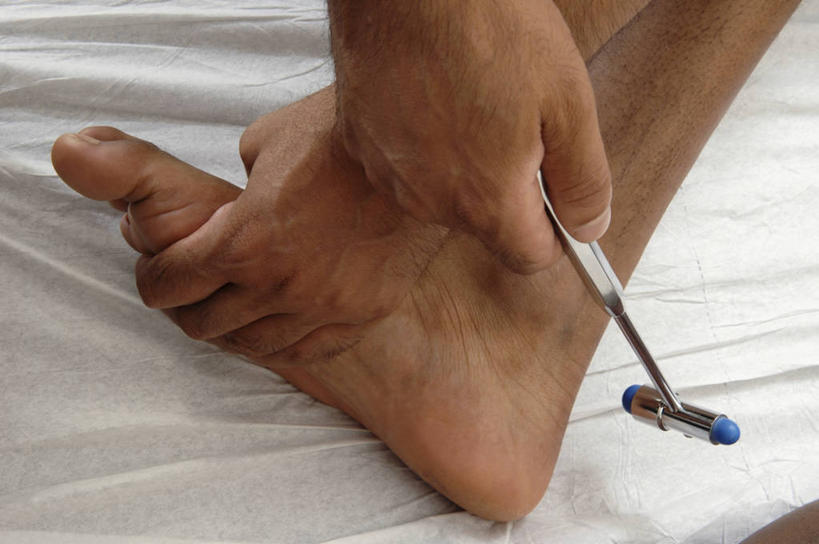 手,关节,踝,两个人,医生,病人,横图,特写,比目鱼,英格兰,医护人员,医疗人员,击打,摄影,部分,足,敲诊槌,大夫,彩图,影棚拍摄