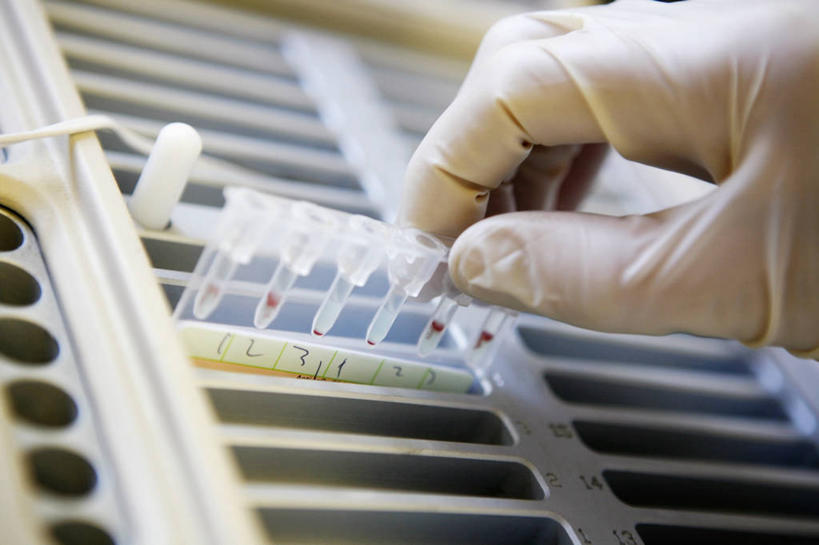 手,一个人,科学家,医院,横图,室内,特写,拿着,英格兰,生病,摄影,部分,放入,装货,科学实验,离心分离机,彩图