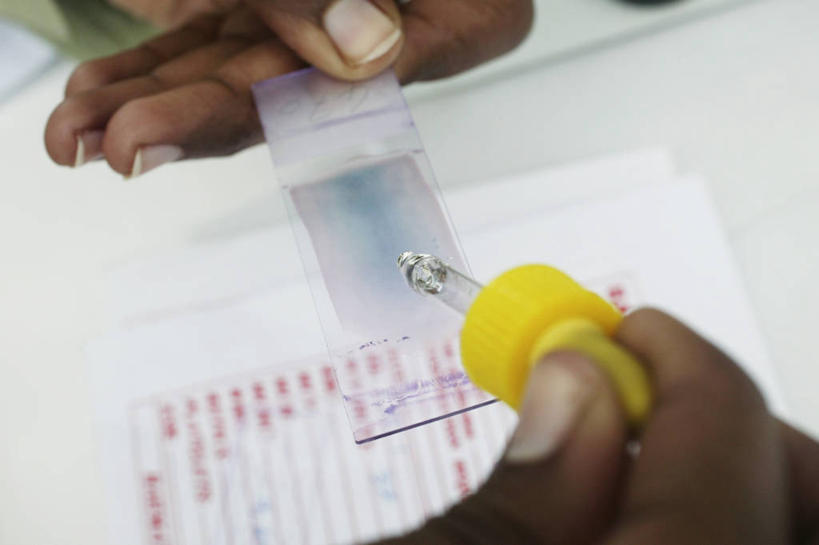 手,一个人,横图,室内,特写,白天,化妆,苏丹,研究,材料,档案,文件,实验室,拿着,资料,手指,摄影,部分,文档,载玻片,吸液管,玻片,盖玻片,彩图,病历