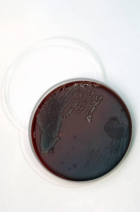 无人,竖图,俯视,室内,特写,白色背景,微生物,苏丹,研究,科学,细菌,两个,打开,血液,摄影,生长,生物学,开启,验血,皮氏培养皿,败血病,生物化学,微生物学,彩图,高角度拍摄