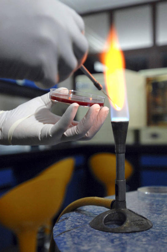 手,一个人,竖图,室内,特写,白天,正面,工作服,制服,安全,火,苏丹,研究,科学,火焰,实验室,防护,燃烧,拿着,手套,血液,摄影,生长,保护,部分,卫生,保险,防护服,皮氏培养皿,本生灯,保全,周全,安稳,安定,防护手套,败血病,工作制服,生物化学,微生物学,平安,彩图,工作套服,琼脂