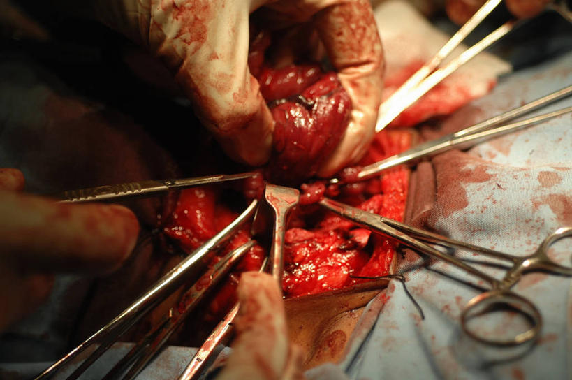 手,内脏,气管,动脉,静脉,横图,室内,特写,安全,科学,医学,防护,手套,血液,人体,摄影,保护,部分,手术,生物学,人体器官,器官,解剖刀,保险,腺体,癌症,保全,周全,安稳,安定,防护手套,甲状腺,手术器械,自然科学,博物学,生物科学,平安,彩图