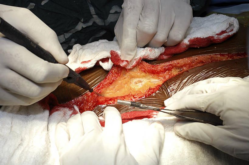 手,两个人,医院,横图,室内,特写,白天,安全,防护,拿着,手套,纸巾,血液,摄影,皮肤,保护,部分,手术,伤口,手术室,准确,解剖刀,保险,切断,外科医生,保全,周全,安稳,安定,防护手套,技能,平安,彩图