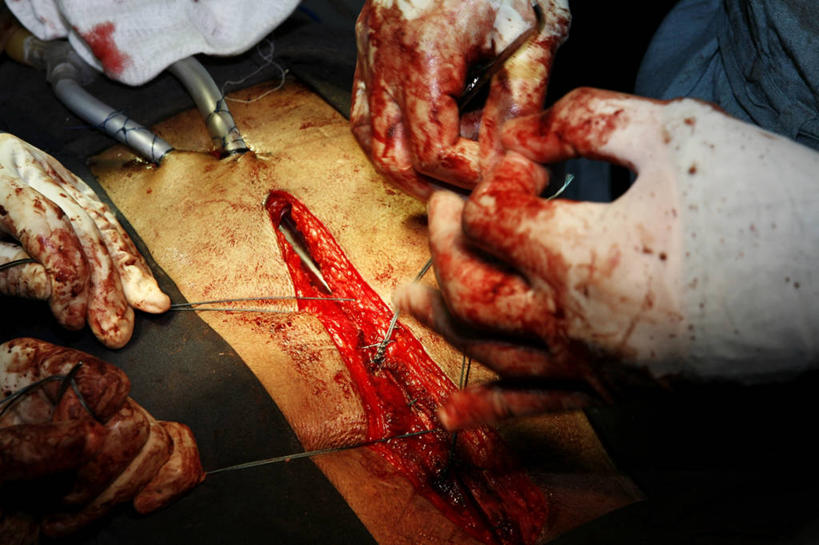 成年人,手,三个人,医生,横图,俯视,特写,安全,不锈钢,管子,防护,拿着,手套,职业,躯干,血液,摄影,皮肤,缝纫,保护,部分,手术,准确,拼接,保险,医疗工具,外科医生,保全,周全,安稳,安定,缝合,防护手套,手术器械,平安,胸部,彩图,高角度拍摄,吸气管