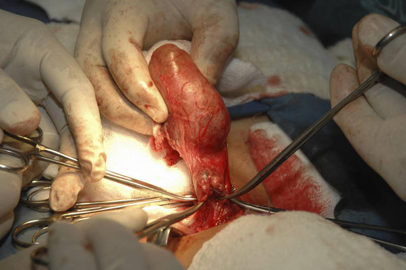 脖子,手,内脏,动脉,静脉,横图,俯视,室内,特写,安全,科学,医学,镊子,纱布,防护,拿着,手套,血液,人体,摄影,保护,部分,手术,生物学,人体器官,手术室,器官,保险,医疗工具,腺体,外科医生,保全,周全,安稳,安定,防护手套,甲状腺,自然科学,博物学,生物科学,平安,彩图,高角度拍摄