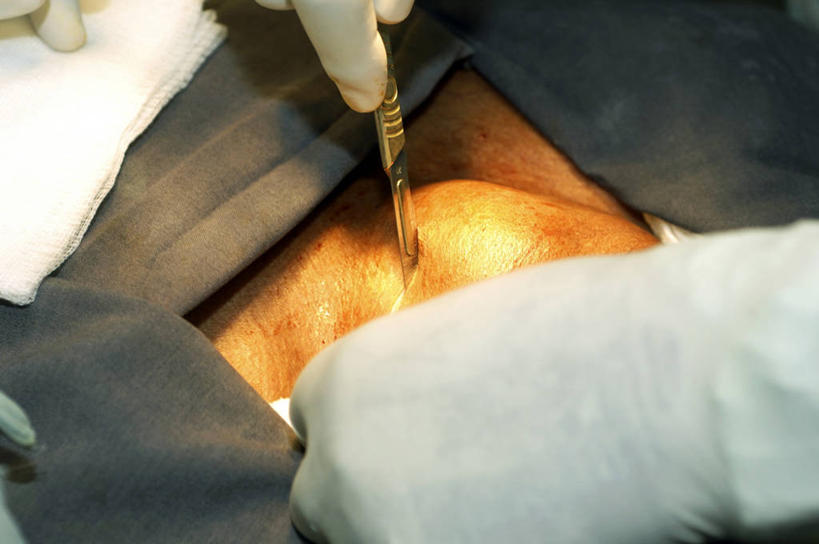 手,两个人,医院,横图,室内,特写,白天,安全,苏丹,防护,手套,摄影,皮肤,保护,部分,手术,手术室,解剖刀,保险,切断,外科医生,保全,周全,安稳,安定,防护手套,甲状腺,平安,彩图