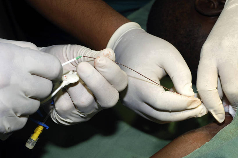 手,血管,三个人,横图,俯视,室内,特写,工作服,制服,化妆,安全,苏丹,防护,拿着,手套,摄影,保护,部分,手术,手术室,金属丝,保险,医疗工具,外科医生,保全,周全,安稳,安定,防护手套,颈内静脉,工作制服,四肢,导尿管,平安,手臂,彩图,高角度拍摄,工作套服,手术衣,颈外静脉