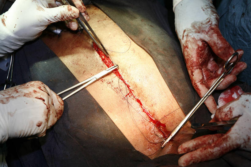 手,三个人,横图,特写,安全,镊子,防护,手套,血液,摄影,缝纫,保护,部分,手术,伤口,拼接,保险,外科医生,保全,周全,安稳,安定,防护手套,手术器械,平安,彩图