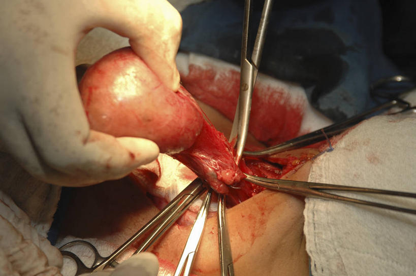 脖子,手,内脏,动脉,静脉,横图,俯视,室内,特写,安全,科学,医学,镊子,纱布,防护,拿着,手套,血液,人体,摄影,保护,部分,手术,生物学,人体器官,手术室,器官,保险,医疗工具,腺体,外科医生,保全,周全,安稳,安定,防护手套,甲状腺,自然科学,博物学,生物科学,平安,彩图,高角度拍摄