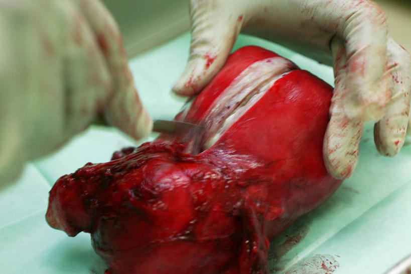 成年人,手,卵巢,一个人,横图,室内,特写,安全,英国,防护,拿着,手套,血液,摄影,保护,部分,手术,准确,解剖,解剖刀,保险,切断,输卵管,保全,周全,安稳,安定,防护手套,子宫颈,手术器械,平安,彩图