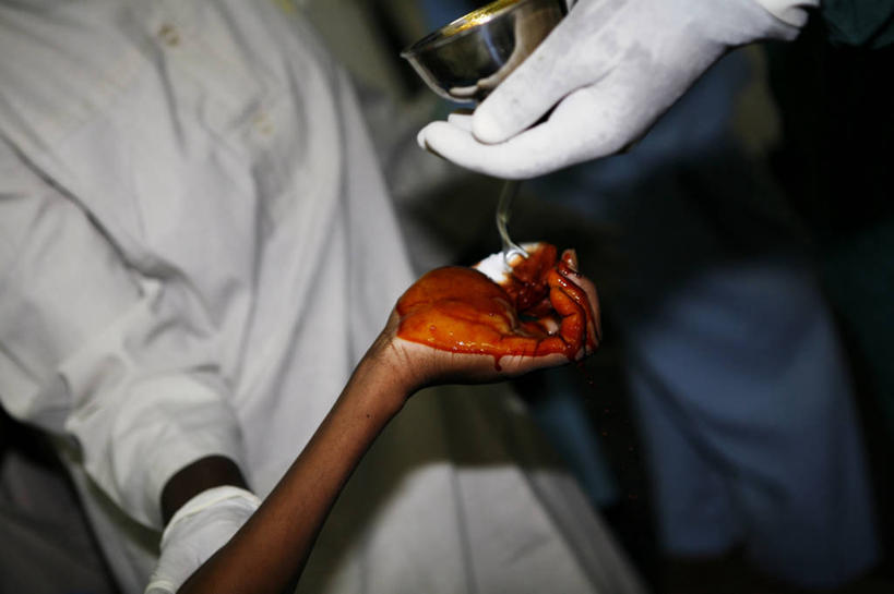 手,手掌,三个人,病人,横图,室内,特写,化妆,美容,倒,护肤,化妆棉,化妆品,保养,享受,休闲,放松,保健,摄影,部分,手术,化妆用品,肿瘤,养颜,外科医生,碘,清洗,彩图