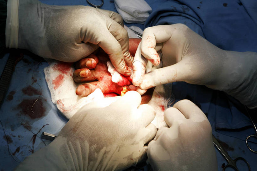 成年人,手,三个人,推,横图,室内,特写,安全,纱布,防护,骨头,拿着,手套,血液,摄影,保护,部分,手术,伤口,手术室,拼接,解剖刀,保险,切断,手术台,医疗工具,外科医生,保全,周全,安稳,安定,缝合,防护手套,平安,男人,彩图,神经系统,缝线