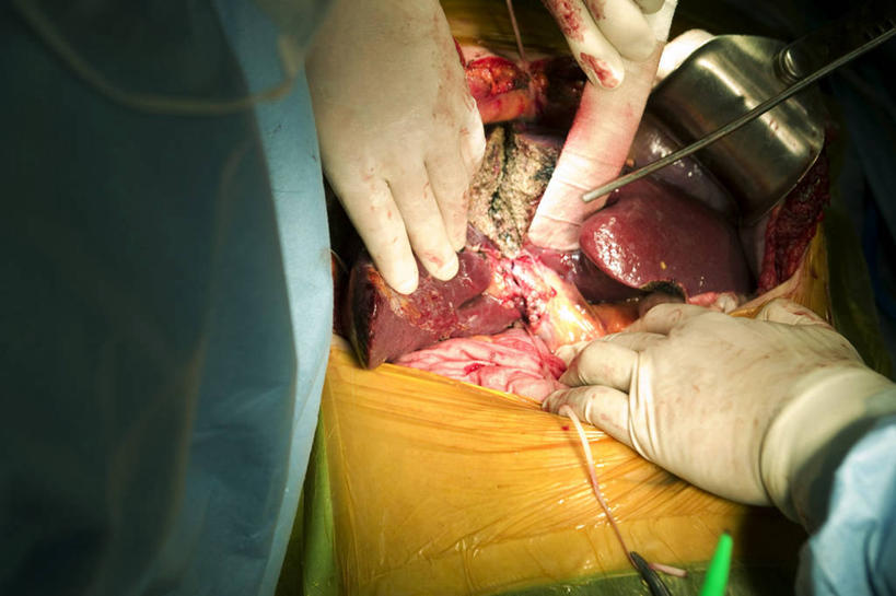 成年人,手,三个人,横图,室内,特写,安全,合作,团队,首尔,韩国,不锈钢,防护,首都,拿着,手套,职业,血液,治疗,摄影,保护,协助,部分,手术,医疗,准确,开刀,保险,切断,医疗工具,外科医生,保全,周全,安稳,安定,防护手套,消化道,吸收,消化管,消化,排泄,手术器械,摄取,平安,彩图,外科手术,消化腺,转运,消化系统