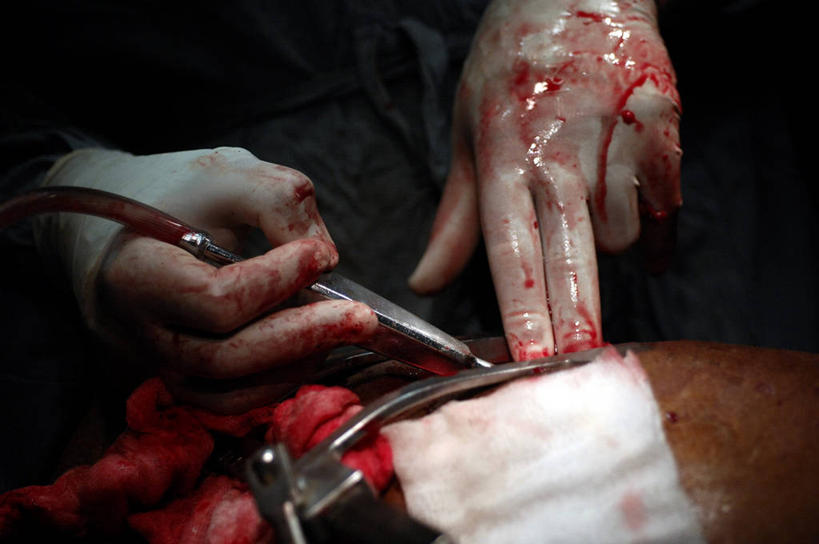 手,一个人,医院,横图,室内,特写,白天,安全,苏丹,镊子,防护,拿着,手套,纸巾,血液,摄影,肮脏,皮肤,保护,部分,手术,伤口,准确,解剖刀,保险,外科医生,邋遢,保全,周全,安稳,安定,防护手套,龌龊,污秽,技能,平安,彩图