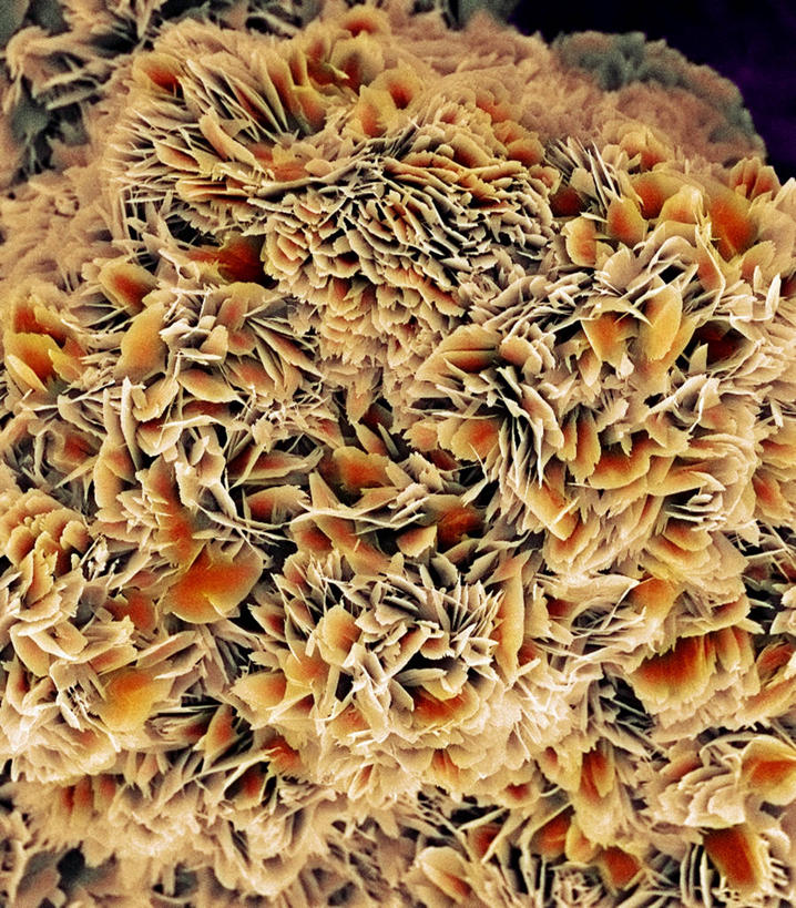 无人,竖图,俯视,室内,特写,白天,仪器,检查,反射,分析,科学,纹路,纹理,显微镜,褐色,晶体,观察,清晰,探索,放大,观看,仔细,透镜,疾病,凸透镜,聚焦,关注,肌理,光学,清楚,结石,显微图片,肾结石,彩图,高角度拍摄,扫描电镜,扫描电子显微镜,肾结晶