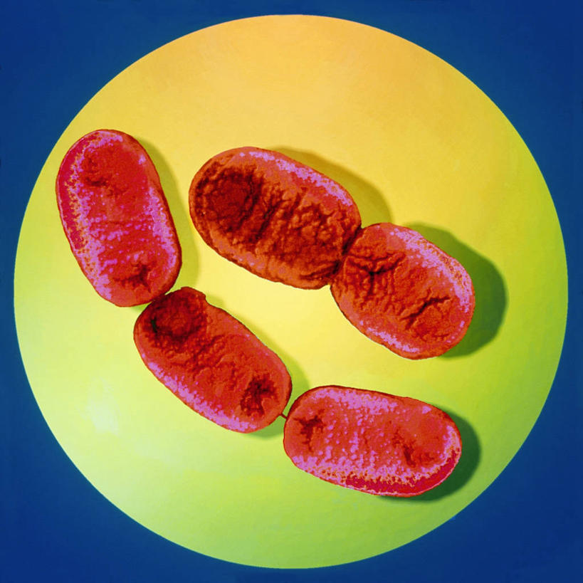 无人,方图,俯视,室内,特写,白天,仪器,微生物,蓝色背景,检查,反射,分析,科学,细菌,圆形,图形,显微镜,圆,几何,黄色,红色,观察,生物,清晰,探索,放大,观看,仔细,透镜,凸透镜,聚焦,关注,数学,光学,清楚,生命体,显微图片,彩图,高角度拍摄,几何图形,平面图形,透射电子显微镜,革兰氏阴性杆菌,革兰氏阴性菌,革兰氏阴性细菌,革兰阴性菌,痢疾杆菌,志贺氏菌属,原核生物