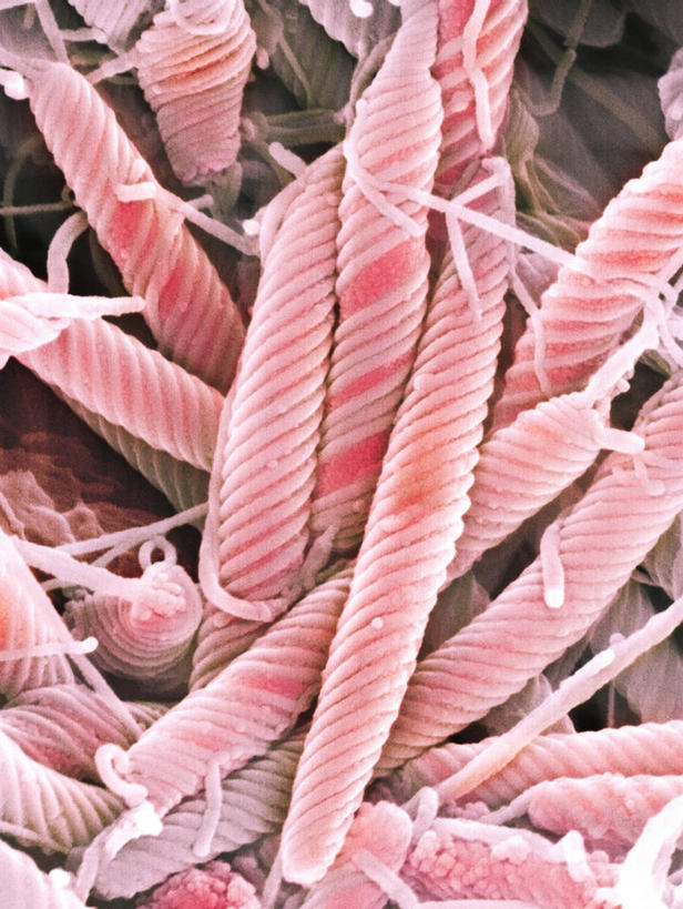 无人,竖图,俯视,室内,特写,白天,仪器,微生物,许多,检查,反射,分析,科学,细菌,显微镜,很多,粉色,观察,生物,清晰,探索,放大,观看,仔细,透镜,凸透镜,聚焦,关注,光学,清楚,生命体,幽门螺杆菌,幽门螺旋杆菌,显微图片,变形菌,螺杆菌,彩图,高角度拍摄,扫描电镜,扫描电子显微镜,原核生物