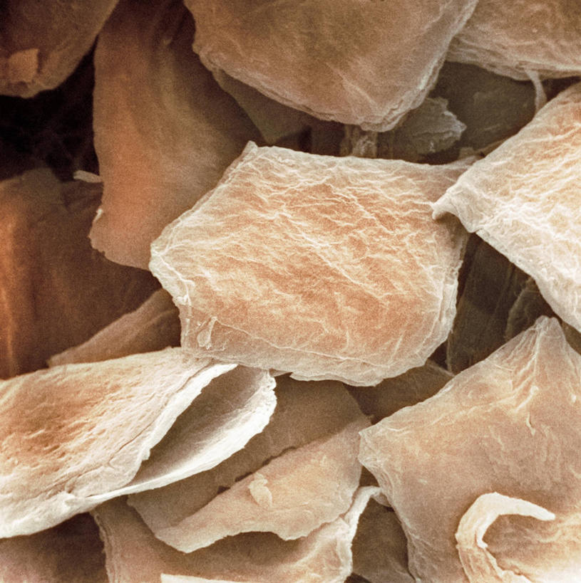 无人,竖图,俯视,室内,特写,白天,仪器,微生物,检查,反射,分析,科学,医学,细胞,显微镜,观察,清晰,探索,放大,观看,皮肤,仔细,透镜,疾病,生物学,凸透镜,聚焦,关注,皮肤病,光学,清楚,显微图片,彩图,高角度拍摄,扫描电镜,扫描电子显微镜