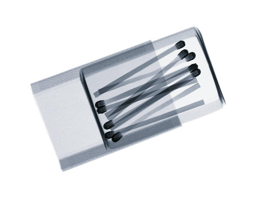 无人,横图,黑白,x光片,室内,特写,白天,白色背景,正面,辐射,科学,医学,火柴,纸盒,盒子,火柴盒,包装盒,容器,储藏,医疗,科学技术,x射线,洋火,储存,x光,火柴梗,取火工具,贮存,电磁波,电磁辐射