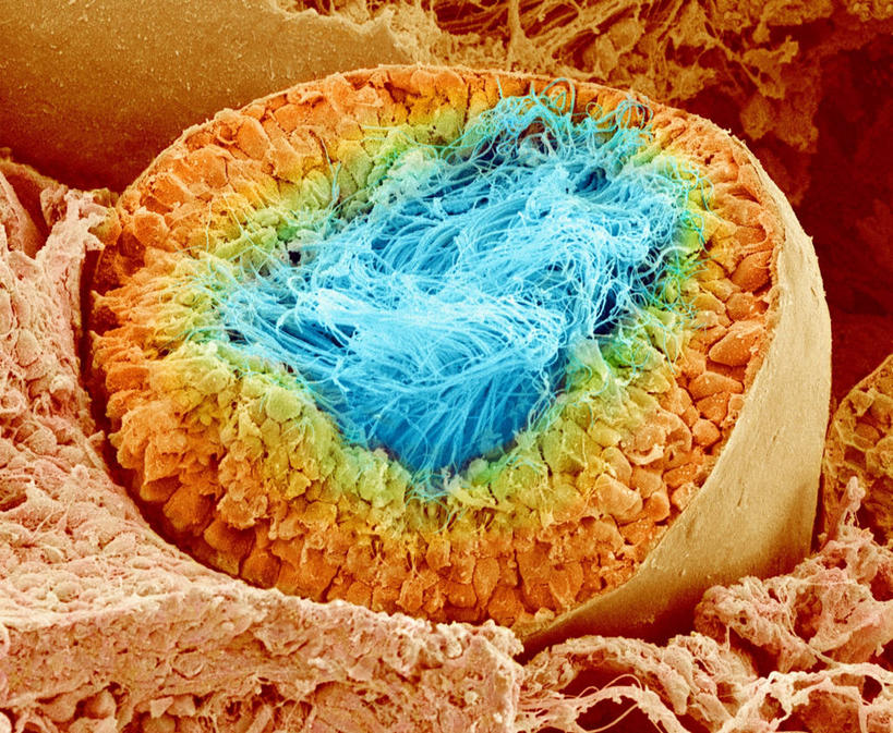 膀胱,睾丸,阴囊,尿道,无人,横图,俯视,室内,特写,白天,仪器,检查,反射,分析,科学,显微镜,管道,蓝色,精子,观察,橙色,清晰,探索,放大,观看,仔细,透镜,凸透镜,聚焦,关注,泌尿系统,前列腺,光学,清楚,附睾,内生殖器,排泄器官,外生殖器,生殖细胞,输精管,曲细精管,精囊腺,尿道球腺,射精管,显微图片,单倍体生殖细胞,雄配子,雄性生殖细胞,雄性细胞,彩图,高角度拍摄,扫描电镜,扫描电子显微镜,男性生殖系统,生殖器官,精管,生精小管