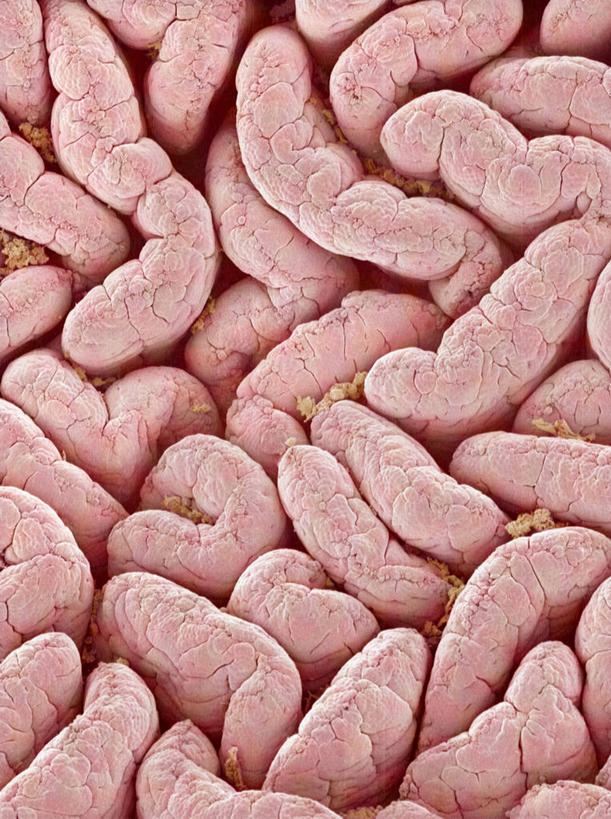 肠,十二指肠,无人,竖图,俯视,室内,特写,白天,仪器,检查,反射,分析,科学,显微镜,粉色,观察,清晰,探索,放大,观看,仔细,透镜,凸透镜,聚焦,关注,光学,清楚,消化道,吸收,消化管,消化,排泄,显微图片,摄取,大肠,盲肠,小肠,直肠,彩图,高角度拍摄,扫描电镜,消化腺,转运,扫描电子显微镜,消化系统