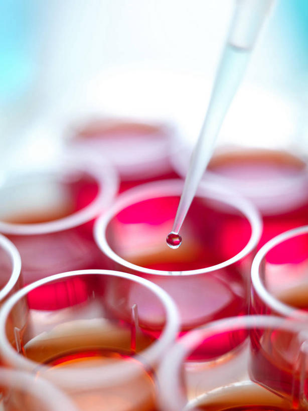 无人,竖图,俯视,室内,特写,白天,实验,仪器,微生物,杯子,许多,阴影,朦胧,模糊,研究,透明,反射,分析,科学,化学,基因,医学,测试,滴管,试管,细胞,影子,实验室,研究室,很多,玻璃制品,红色,玻璃瓶,瓶子,器皿,生物,遗传,生物学,脱氧核糖核酸,计量,试验室,玻璃仪器,试验耗材,实验用品,吸液管,移液管,DNA分子,去氧核糖核酸,遗传信息,遗传因子,遗传学,玻璃杯,彩图,高角度拍摄,起源细胞,万用细胞,未分化细胞,干细胞