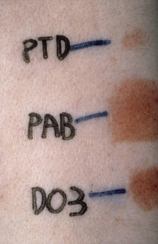 西方人,一个人,竖图,室内,特写,白天,正面,欧洲,欧洲人,仅一个女性,仅一个人,英文,标志,文字,字符,字母,标识,仅一个中年女性,生病,英文字母,疾病,皮肤病,过敏,女人,女性,中年女性,白种人,半身,彩图