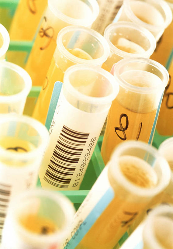 无人,竖图,俯视,室内,特写,白天,电子,实验,仪器,杯子,许多,小便,阴影,研究,透明,反射,分析,信息,化学,测试,标签,符号,试管,数字,影子,很多,标识,玻璃制品,黄色,玻璃瓶,瓶子,器皿,条形码,样本,尿,编码,条码,计量,尿液,玻璃仪器,试验耗材,实验用品,排泄物,还元汤,轮回酒,人尿,玻璃杯,彩图,高角度拍摄,商业