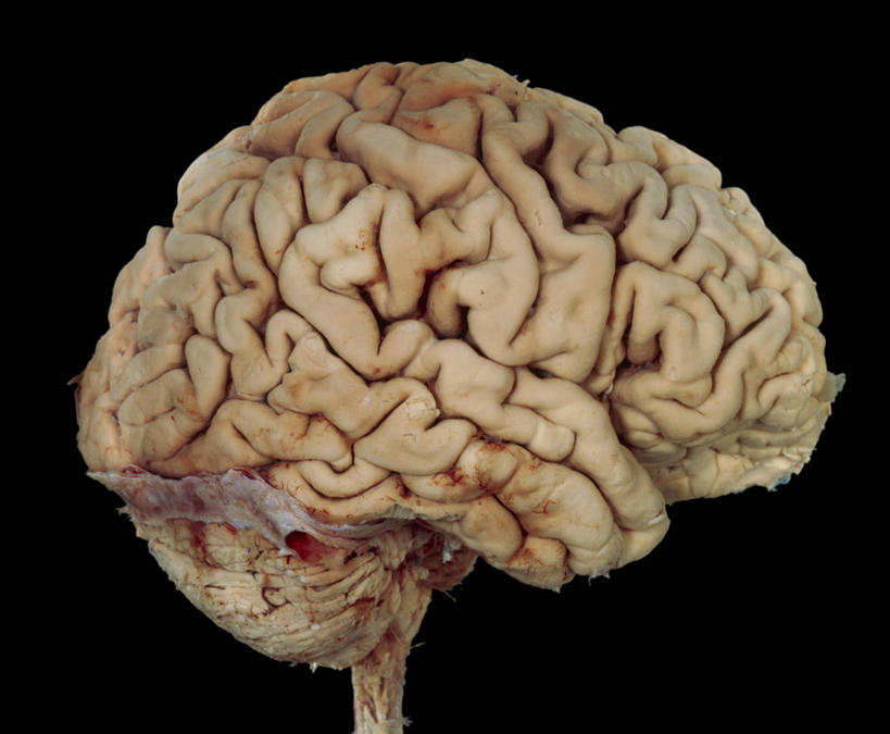 脑,脊髓,脊椎,无人,横图,室内,特写,白天,正面,大脑,黑色背景,纹路,纹理,一个,单个,器官,沟壑,小脑,脑干,肌理,大脑皮层,端脑,沟,灰质,回,间脑,脊神经,脑神经,中枢神经系统,周围神经系统,脊柱,彩图,调节系统,植物性神经,周围神经,神经系统,中枢神经