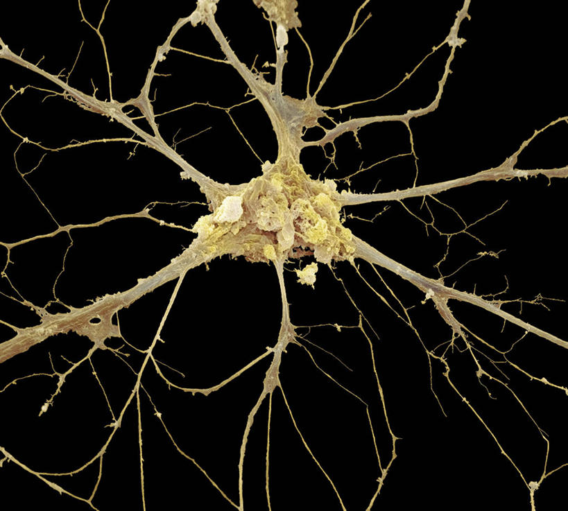 无人,横图,室内,白天,正面,仪器,微生物,检查,反射,分析,科学,医学,纹路,纹理,细胞,显微镜,黄色,观察,清晰,探索,放大,观看,仔细,透镜,生物学,凸透镜,聚焦,关注,神经元,肌理,光学,清楚,树突,神经细胞,显微图片,细胞突起,彩图,扫描电镜,扫描电子显微镜