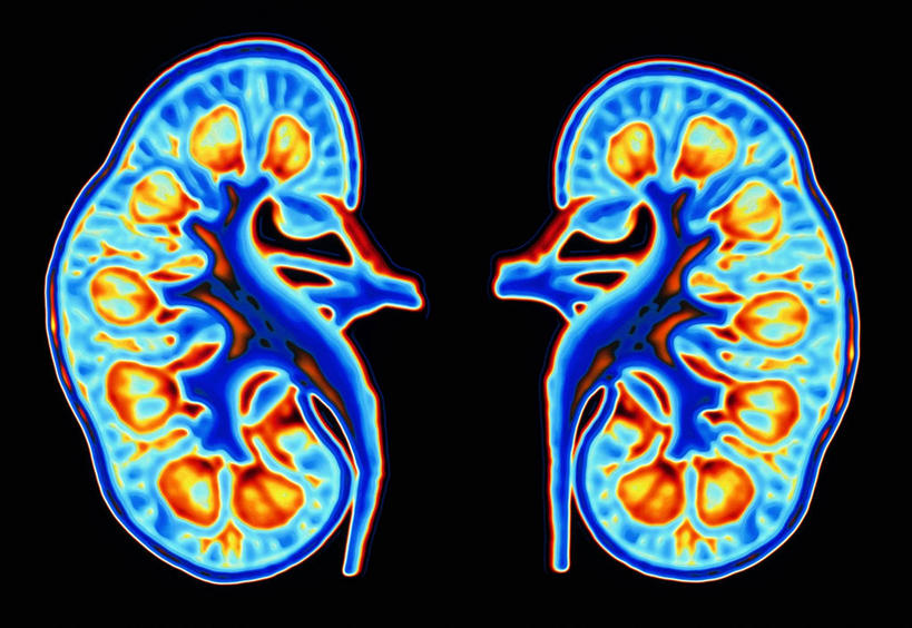 内脏,肾脏,动脉,静脉,无人,横图,插画,室内,白天,正面,数码,科技,阴影,科学,网络,医学,纹路,纹理,高光,几何,计算机图形,合成,图画,画,人体,保护,电脑合成图,数码合成图,生物学,人体器官,器官,合成图,漫画,保护膜,输尿管,肌理,写实,具体,具象,髓鞘,自然科学,博物学,生物科学,彩图,髓磷脂鞘