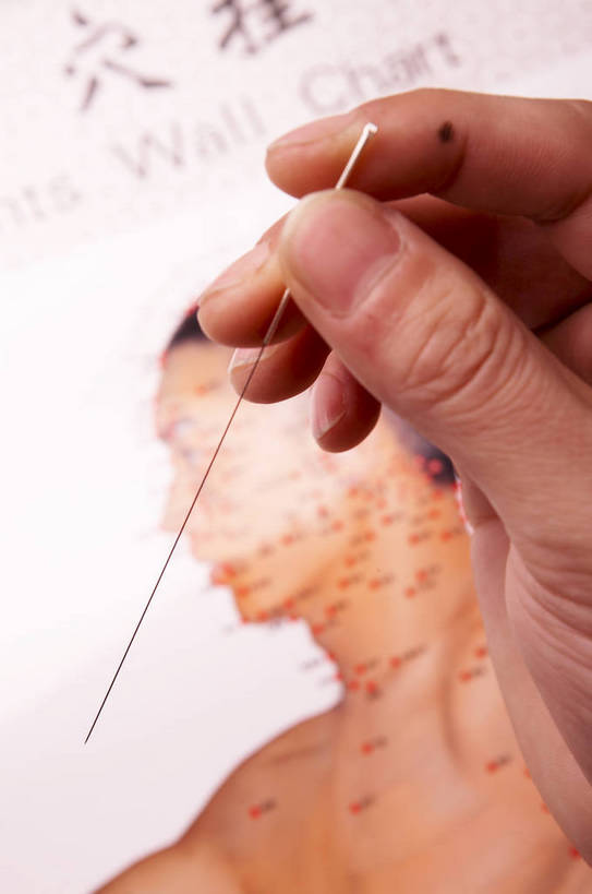 手,一个人,摄影师,捏,竖图,室内,特写,房间,静物,局部,工作,医学,图片,文化,针,概念,治疗,摄影,生活方式,动作,医疗,穴位,看病,解剖,近景,中国文化,针灸,中医,摄像师,中医学,非物质文化遗产,剖解,传统文化,bj174