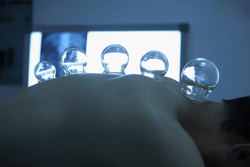 东方人,成年人,中年人,一个人,病人,医院,横图,x光片,室内,侧面,杯子,北京,中国,亚洲,朦胧,模糊,辐射,科学,医学,墙,文化,传统,裸露,健康,躯干,治疗,吸,保健,摄影,灯箱,部分,后背,真空,医疗,疾病,科学技术,x射线,关爱,中国文化,裸,x光,医疗工具,拔火罐,中医,火罐,东亚,医治,替代疗法,解决,拔罐,拔罐疗法,拔罐子,火罐疗法,中医学,男人,男性,中年男性,亚洲人,中国人,彩图,奖杯,传统文化,电磁波,电磁辐射,门诊部,物理疗法,bj175