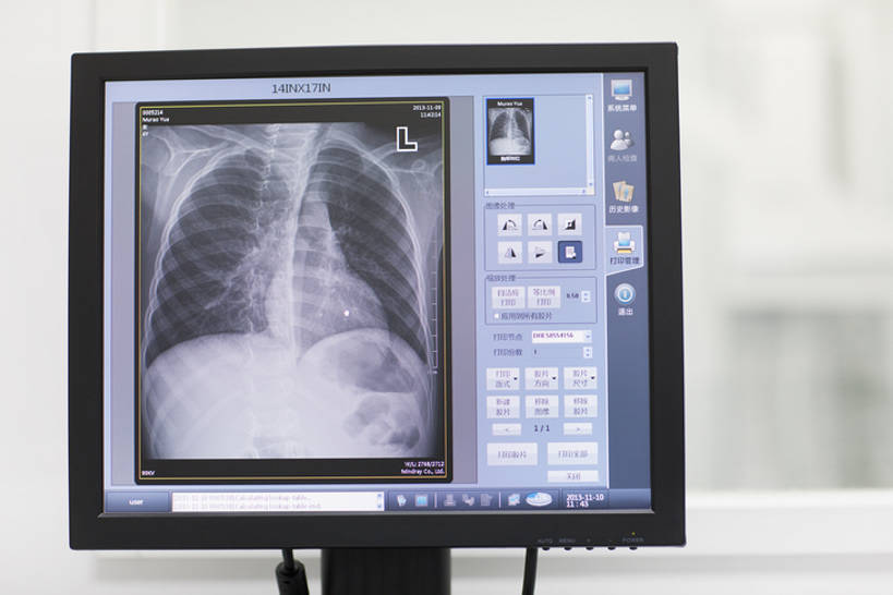 骨骼,无人,办公室,医院,横图,x光片,室内,特写,机器,显示器,技术,窗户,北京,中国,亚洲,检查,辐射,科学,医学,器材,放射,设备,现代,医疗用品,观察,职业,机械,服务,人体,摄影,技巧,控制,体检,察看,检测,医疗,医疗设备,胸腔,科学技术,操作,x射线,调查,手艺,医疗器械,x光,医疗工具,监控,监视,考察,东亚,控制室,监控设备,CAT扫描仪,无线电技术,观测,视察,无线电波,监控设置,监控装备,检测器,技能,技艺,检测工具,计算机,彩图,计算机X射线轴向分层造影扫描仪,计算机轴向断层扫描,妙技,x射线衍射,x射线衍射仪,射线检测器,电磁波,电磁辐射,本领,放射疗法,体格检查,bj175